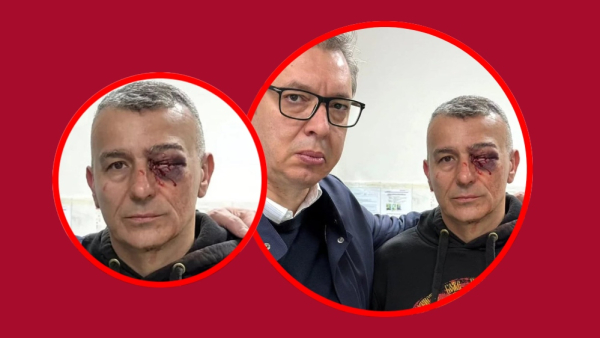 Policajac Lazar Baćić potvrdio da su ga povredile kolege, a ne studenti